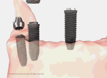 1.gif